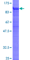 12.5% SDS-PAGE Stained with Coomassie Blue